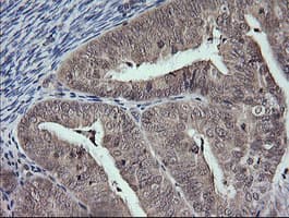 MAP2K3 / MEK3 / MKK3 Antibody (clone OTI5G5)