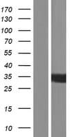 KIAA1191 Protein (Over-Expression Lysate Myc-DDK (Flag))