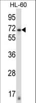 ZNF415 Antibody (aa155-184)