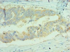 MICA Antibody (aa24-307)