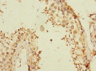 TEX43 / C5orf48 Antibody