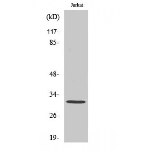 Polyclonal Rabbit anti-Human SURF1 Antibody (140-220 aa, Internal, IHC, IF, WB)