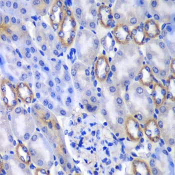 MATK Antibody