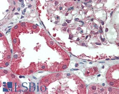 IHC-plus™ ADGRF5 / GPR116 Antibody (N-Terminus)