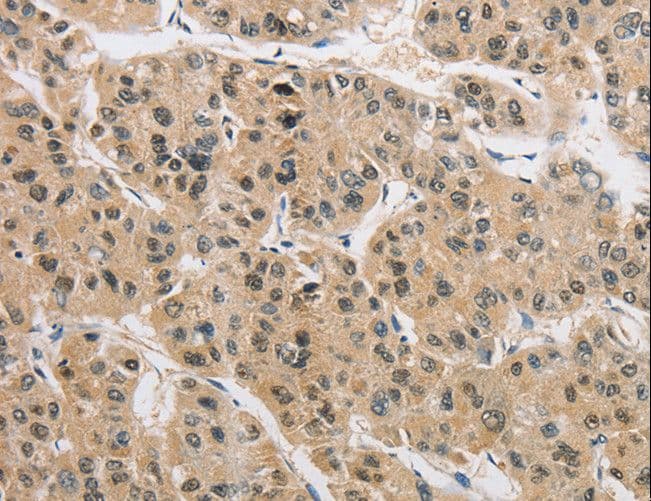 AMZ2 Antibody