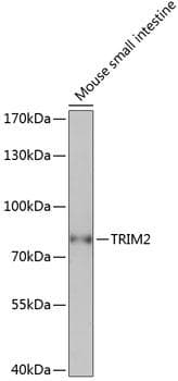 KIAA0517 / TRIM2 Antibody