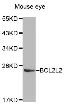 PathPlus™ Polyclonal Rabbit anti-Human BCL2L2 / Bcl-w Antibody (IHC, WB)