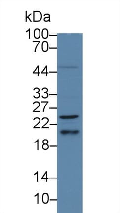 HRAS / H-Ras Antibody (aa82-176, PE)