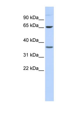EPN2 Antibody (aa180-229)