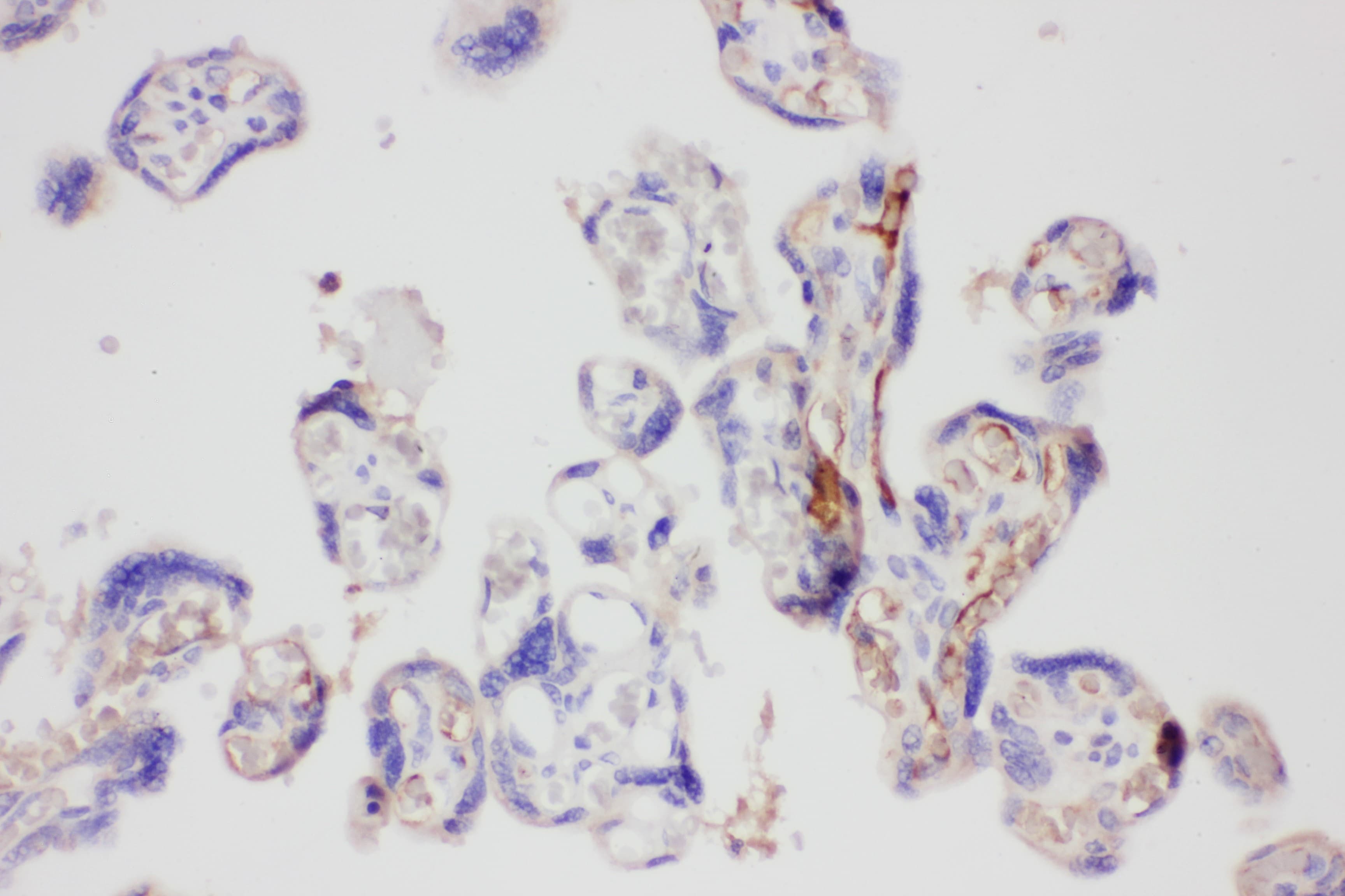 LGALS3 / Galectin 3 Antibody (aa139-250)