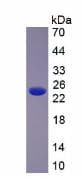 Human SLIT2 Protein (Recombinant His, N-Terminal)