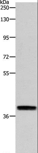 RTN4 / Nogo Antibody