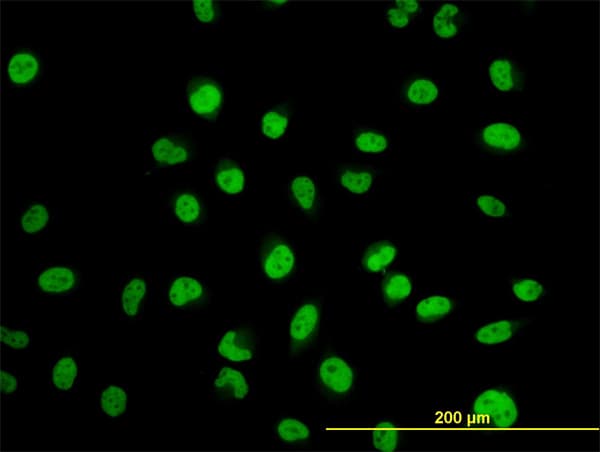Monoclonal Mouse anti-Human MYNN Antibody (clone 3E8, IHC, IF, WB)