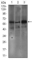 Monoclonal Mouse anti-Human FcERI / Fc Epsilon RI Antibody (clone 1F2A9, Amino Acid: 42-103, WB)