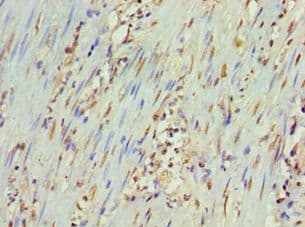 PPP1R1B / DARPP-32 Antibody (aa1-168)