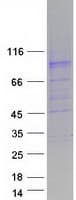 Human SLC26A4 / Pendrin Protein (Recombinant Myc-DDK (Flag))