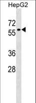 ZNF419 Antibody (aa176-202)