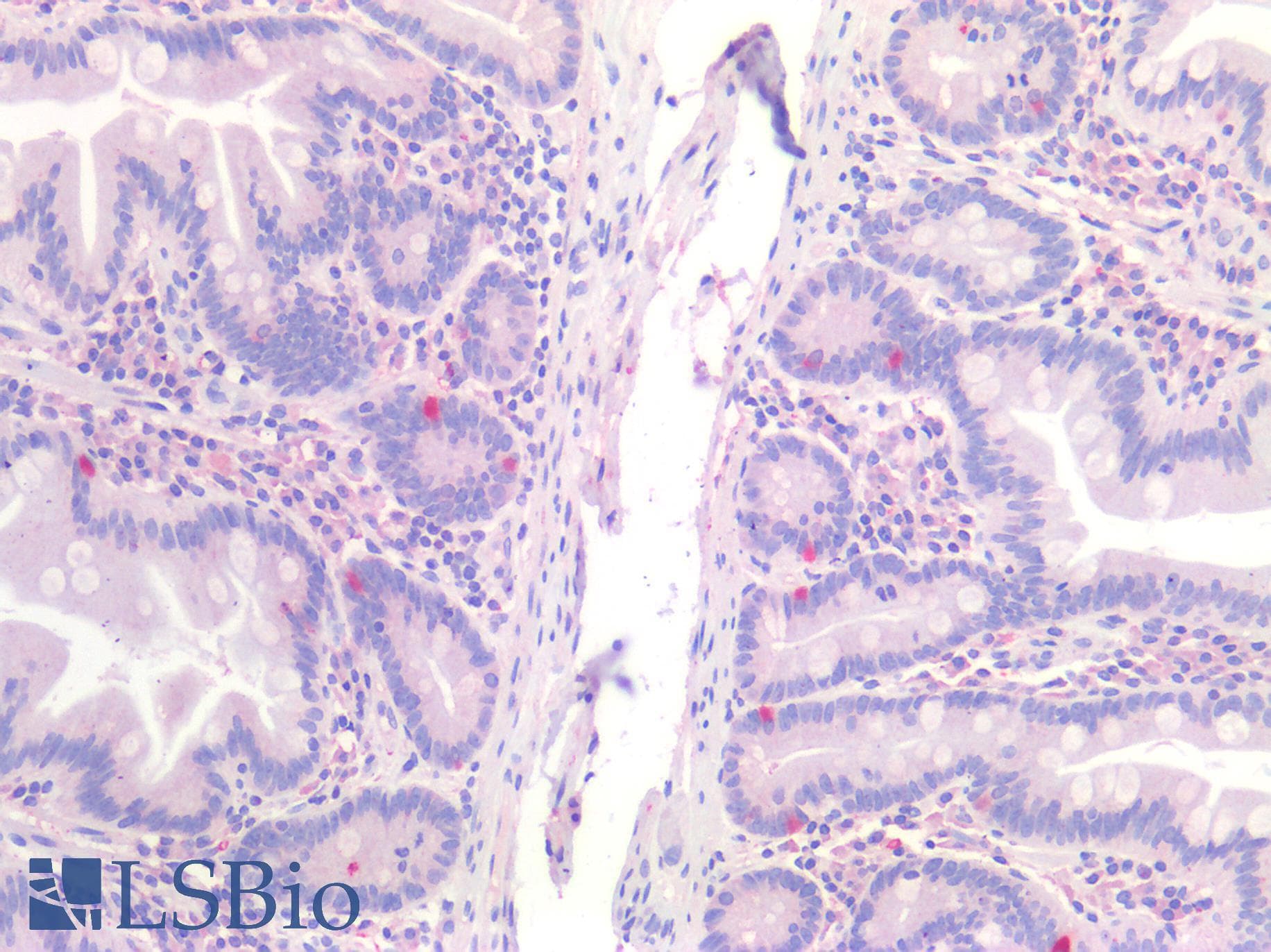IHC-plus™ SST / Somatostatin Antibody