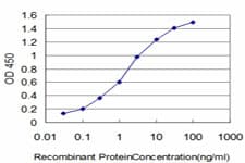 IHC-plus™ HOXB7 Antibody (clone 4C6)