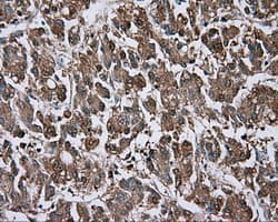 Monoclonal Mouse anti-Human BTK Antibody (clone OTI3D11, IHC, IF, WB)