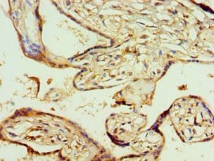 Polyclonal Rabbit anti-Human AGPAT1 Antibody (aa204-283, IHC, WB)