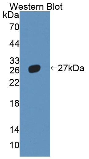NR5A2 / LRH-1 Antibody (aa1-205, Cy3)