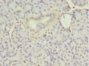 EIF4EBP3 Antibody (aa1-100)