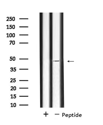 Polyclonal Rabbit anti-Human SLC17A2 Antibody (IF, WB)
