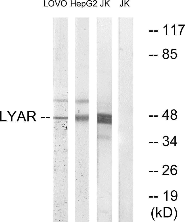LYAR Antibody