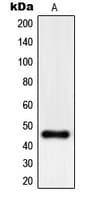 PHKG1 Antibody (Internal)