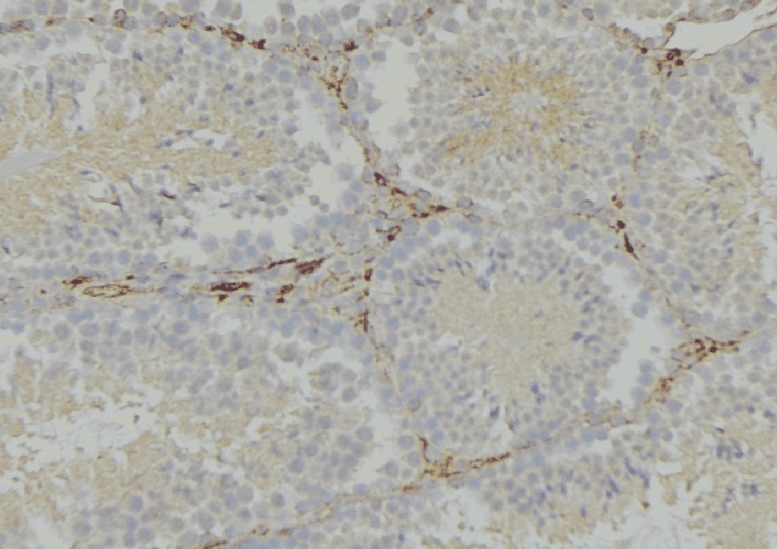 IFNAR1 / IFNAR Antibody