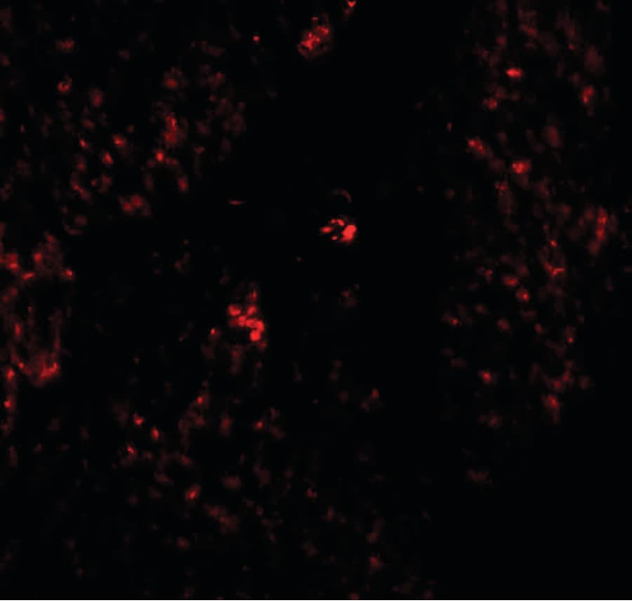 IHC-plus™ HMMR / CD168 / RHAMM Antibody