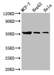 Polyclonal Rabbit anti-Human GBA / Glucosidase Beta Acid Antibody (IHC, WB)