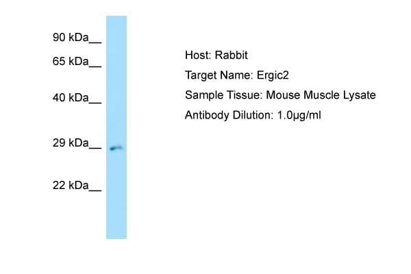 ERGIC2 Antibody (N-Terminus)