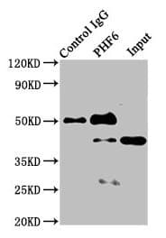 PHF6 Antibody (aa2-312)