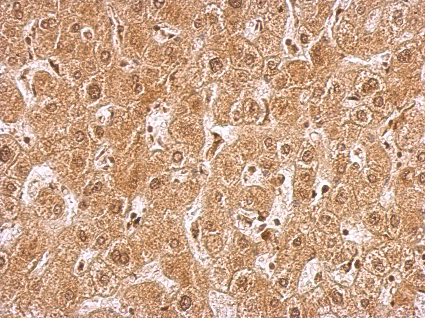 Polyclonal Rabbit anti-Human PRKAG2 / AMPK Gamma 2 Antibody (aa386-569, IHC, WB)