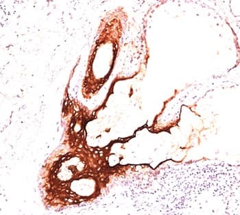KRT17 / CK17 / Cytokeratin 17 Antibody (clone E3, Azide-free, BSA-free)