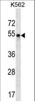 BRN2 / POU3F2 Antibody (aa199-226)