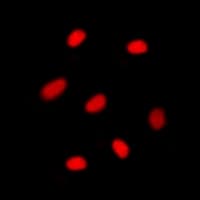 MGMT Antibody (N-Terminus)