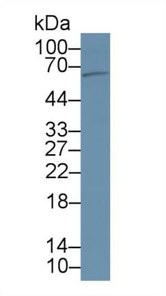 PCSK9 Antibody (aa164-428, PE)