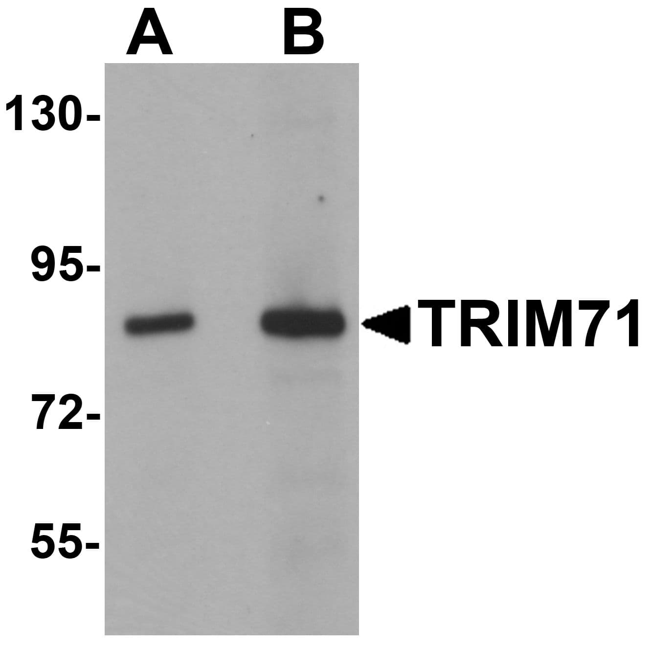 Polyclonal Rabbit anti-Human LIN41 / TRIM71 Antibody (IHC, IF, WB)
