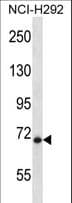 Polyclonal Rabbit anti-Human HIC1 Antibody (aa498-527, WB)