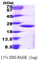 Human ARF1 Protein (Recombinant His)