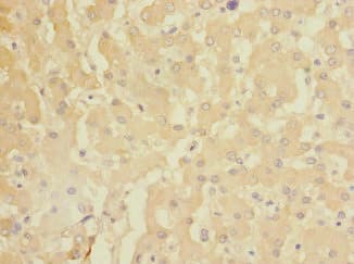 Polyclonal Rabbit anti-Human CR6 / GADD45G Antibody (IHC, WB)