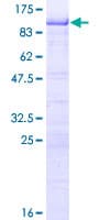 Human RNF168 Protein (Recombinant GST)