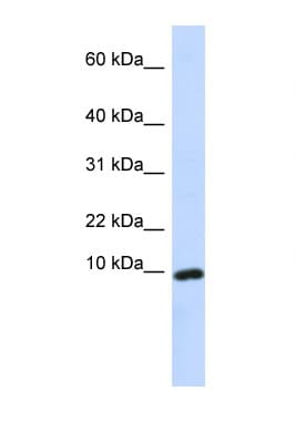 Polyclonal Rabbit anti-Human CXCL9 / MIG Antibody (C-Terminus, WB)