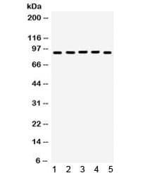EWSR1 / EWS Antibody