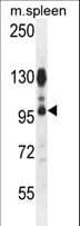 Polyclonal Rabbit anti-Human CENTB1 / ACAP1 Antibody (aa96-125, IHC, WB)