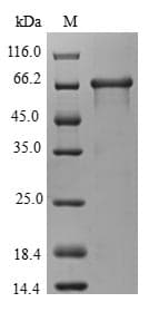 Human WDR45 Protein (Recombinant GST, N-terminus)