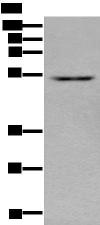 ZNF672 Antibody
